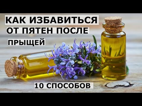 Появилось пигментное пятно на лице у мужчин Идут подружки горят веснушки