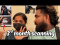 3rd MONTH SCANNING DAY Diyafavas Official