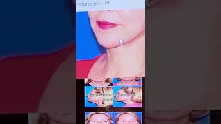 Ranch & Coast Plastic Surgery & Med Spa