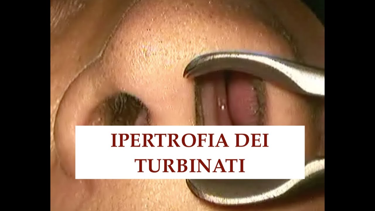 Giuseppe Castellana-11