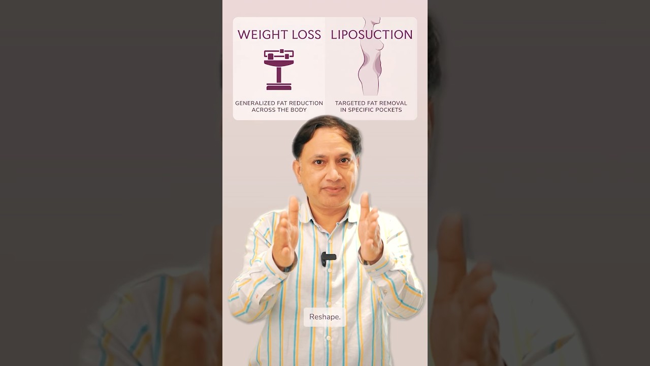 ⚠️ Liposuction Is Not Weight Loss Surgery