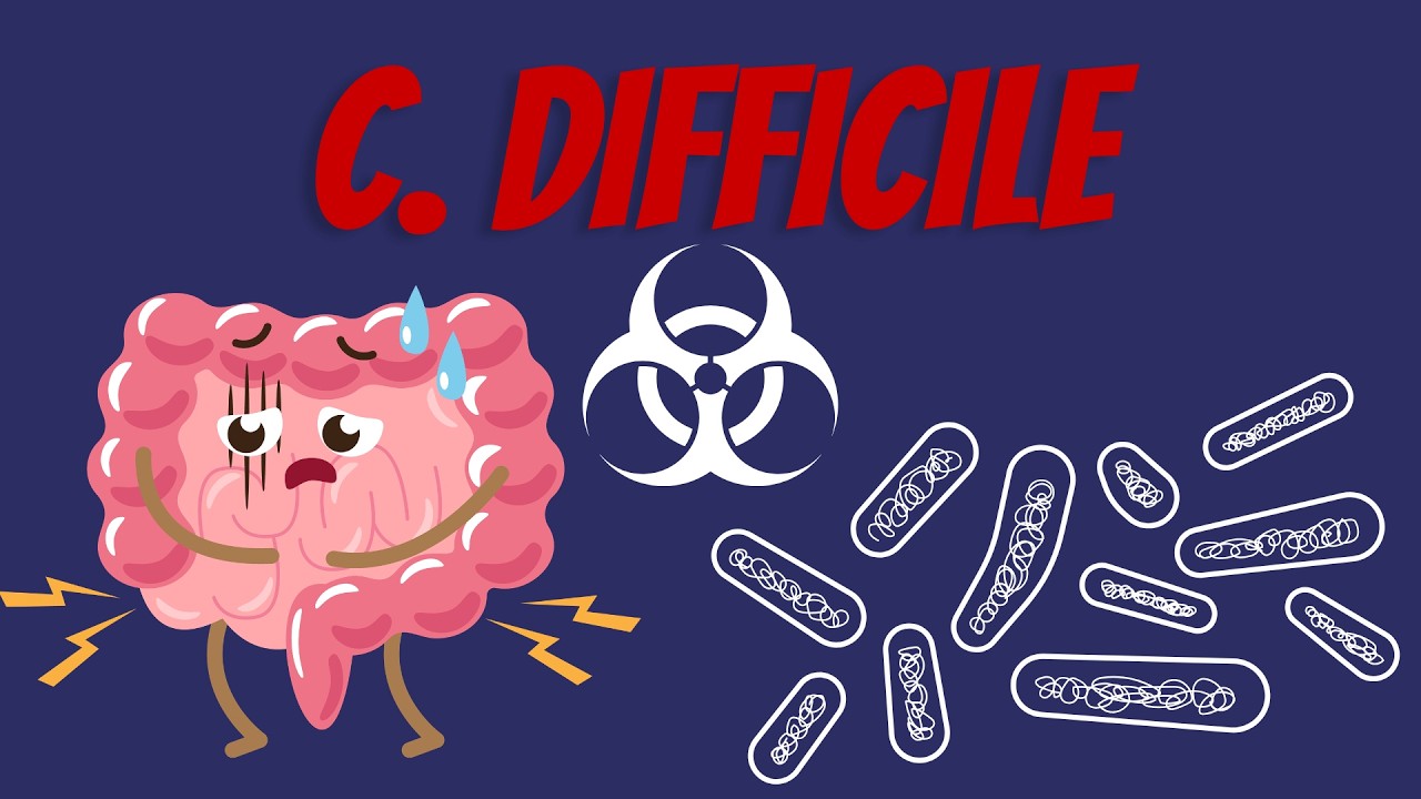 Infección por Clostridioides Difficile Explicado Claramente