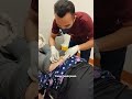 Terapi Tusuk Jarum