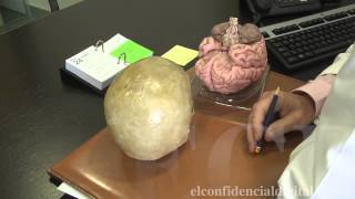 Un neurocirujano explica qué le ocurre a una persona en un accidente como el de Fernando Alonso