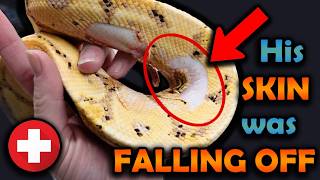 Rescuing a Ball Python whose SKIN was FALLING OFF