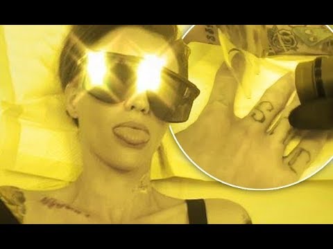 Ruby Rose flaunts gets tattoo removal