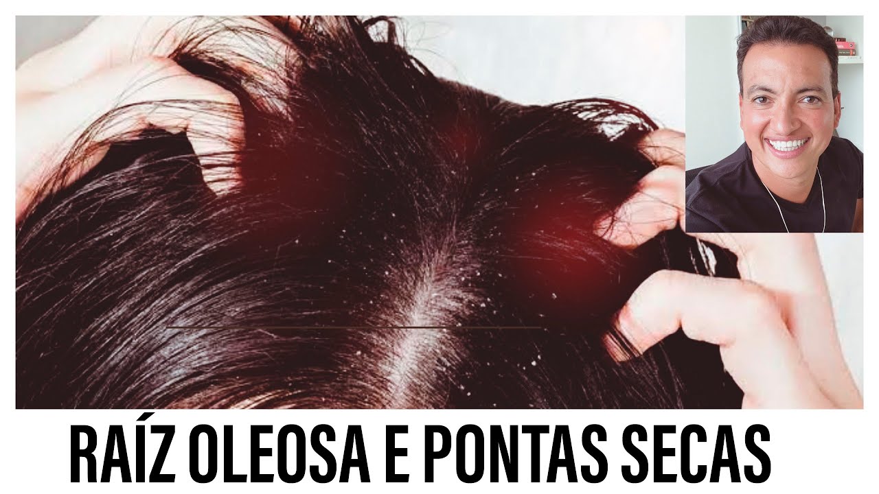 RAÍZ OLEOSA E PONTAS SECAS, O QUE FAZER