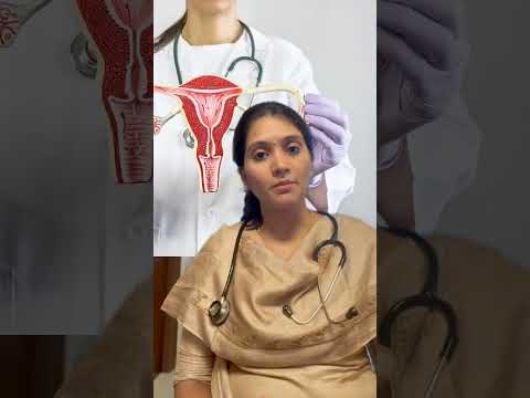 What is Hysterectomy? Everything Women Should Know | Dr. Deepeka T S