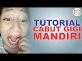 Cabut Gigi Tanpa Harus Ke Dokter Gigi KorTuGi