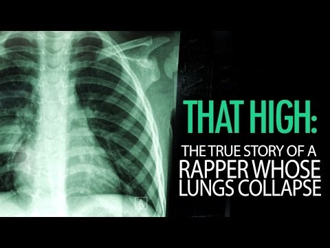 download lagu mp3 mp4 COLLAPSED LUNG Mp3, download lagu COLLAPSED LUNG Mp3 gratis, unduh video klip COLLAPSED LUNG Mp3