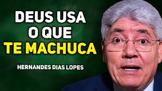 How God Transforms Evil into Good in Your Life | Hernandes Dias Lopes