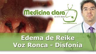 Edema de Reinke | Voz ronca y disfonía | Vídeos de medicina en Youtube