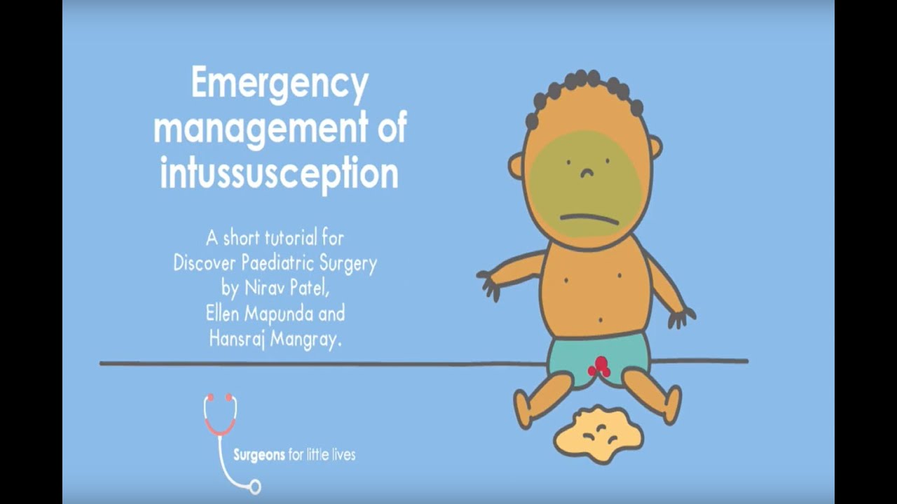 Emergency Management of Intussusception