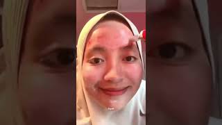 Download lagu Platelet Rich Plasma #vampirtreatment #aesthetic #kecantikan #kecantikankulit mp3