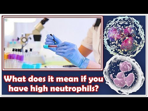 Neutrophils Absolute Count – High, Low (Causes), Normal Range