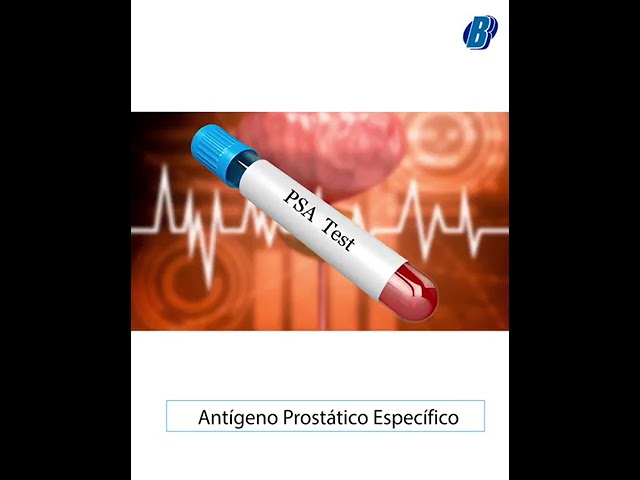 Vídeo