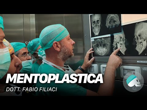 Alterazioni distrofiche degenerative sinovite del ginocchio Vasi sanguigni del Forum Trattamento collo