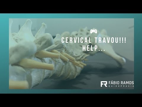 TORCICOLO!!! SAIBA COMO A QUIROPRAXIA PODE TE AJUDAR.