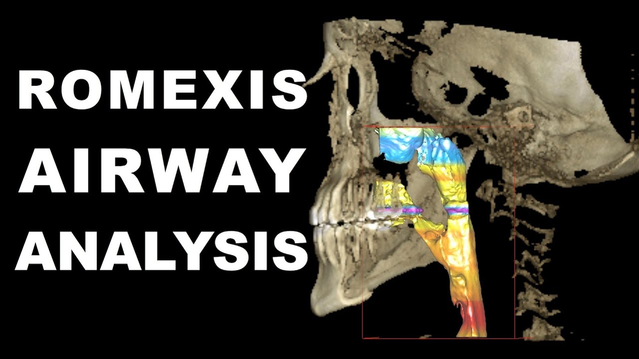 Romexis Airway Analysis