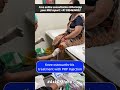 Avoid Knee Replacement Surgery With PRP Injection Askdrmanu
