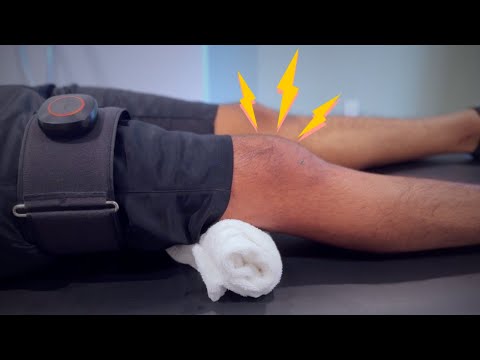 1- Year ACL & Meniscus Surgery Recovery Journey