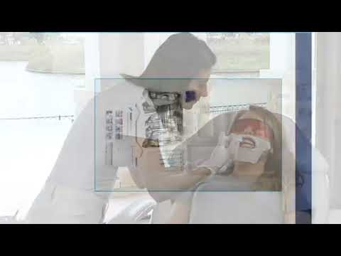 BEYOND OSMO Five Patient Professional Teeth Whitening Kit B