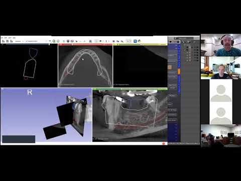 Zoom B4D Guide Module