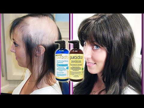 Best Hair Loss Shampoo 2021 - The Ultimate Solution!
