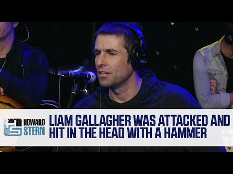 How a Head Injury Led Liam Gallagher Into Music (2017)