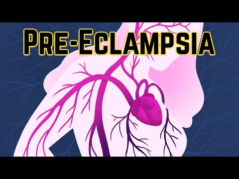 Pre-Eclampsia (updated 2023) - CRASH! Medical Review Series