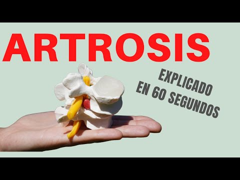 ARTROSIS (Explicado en 60 Segundos)