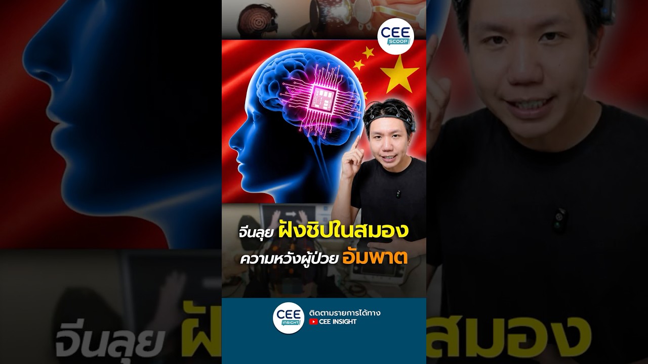ล้ำวงการแพทย์! จีนทดลองเทคโนโลยี BCI ฝังชิปในสมองเต็มรูปแบบ