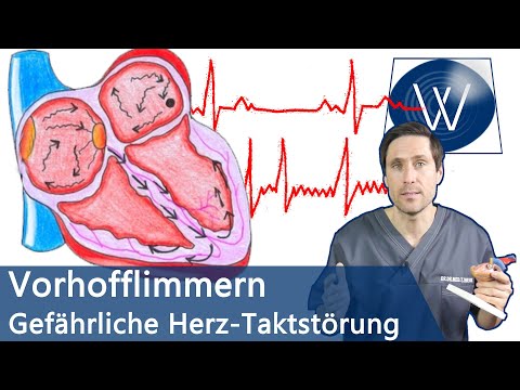 Vorhofflimmern: Wenn Ihr Herz den Takt verliert! Ursachen, Therapie & lebensgefährliche Folgen