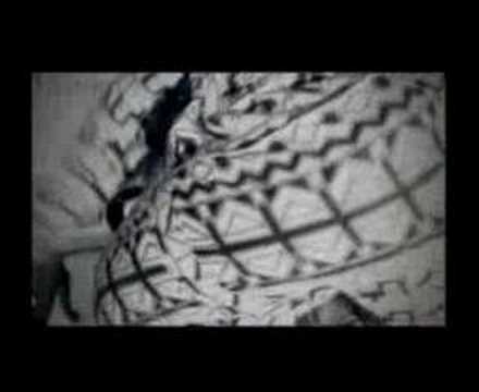 Why You Dey Treat Am - Chemphe