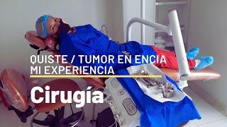 Quiste dental / Tumor dental Cirugía Maxilofacial Mi experiencia: DULCE LENY