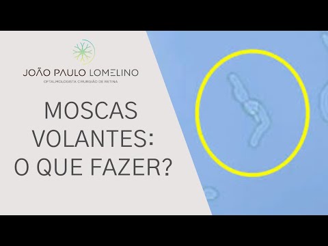 Moscas volantes nos olhos | Dr. João Paulo Lomelino