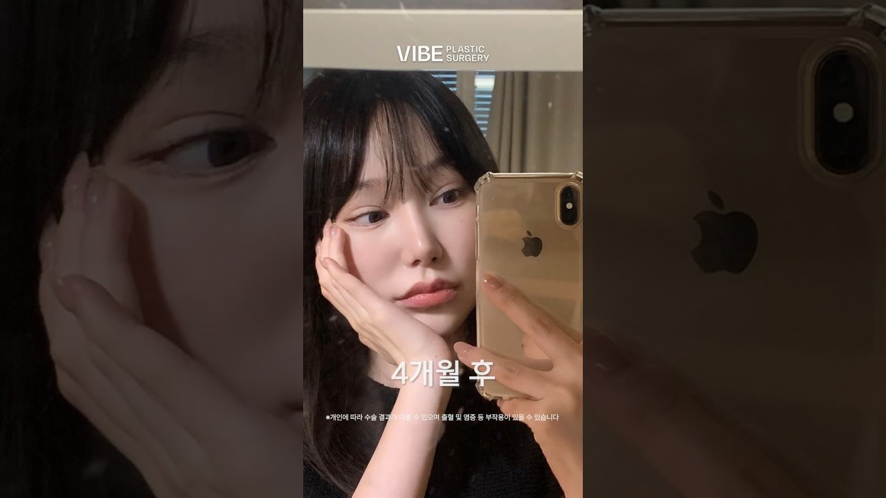 코재수술, 이마거상으로 고급스럽고 매혹적이게🔥