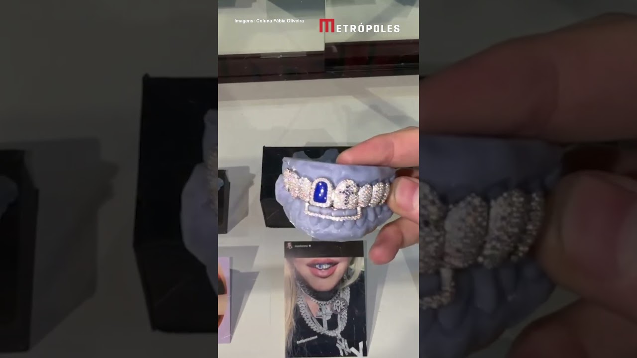 Saiba o valor da joia dental usada por Madonna