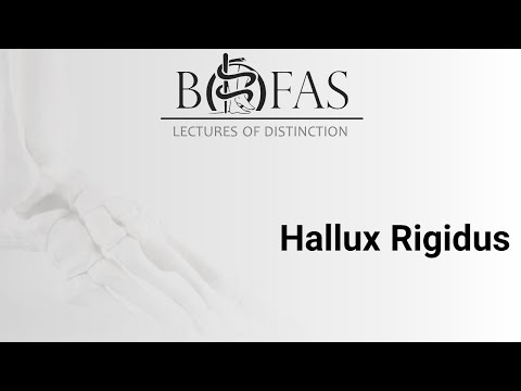 Hallux Rigidus - BOFAS Lectures of Distinction
