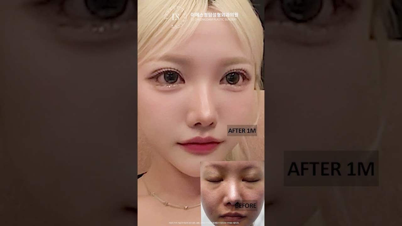이에스 유튜브