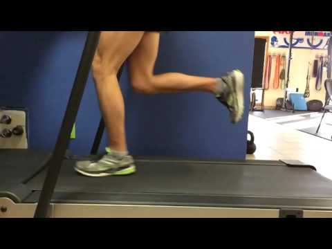 First run back after Haglund's Deformity removal surgery.