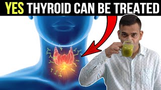 4 Easy Tips To Control Thyroid Issue | Cure Thyroid Problem IN 4 Natural Ways - Dr. Vivek Joshi