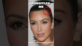 Kim Kardashian si è sottoposta a un trapianto di capelli?