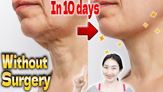Lift Turkey Neck Without Surgery in 10 days! Ultimate Massage for Neck Wrinkles