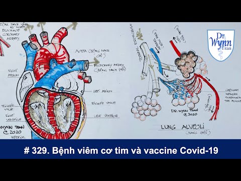 Bệnh viêm cơ tim (Myocarditis) và vaccine Covid-19