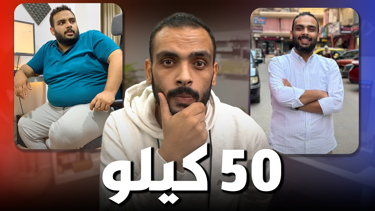 خسيت ٥٠ كيلو في ٦ شهور | مالايخبرونك به عن عمليات السمنة ( تكميم المعدة وتحويل المسار )⚠️