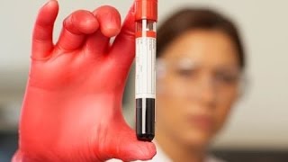 Labs results after becoming vegan