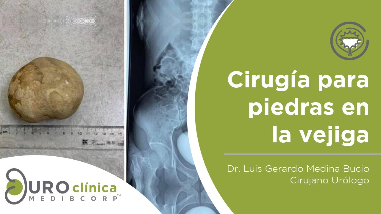 Luis Gerardo Medina Bucio-42