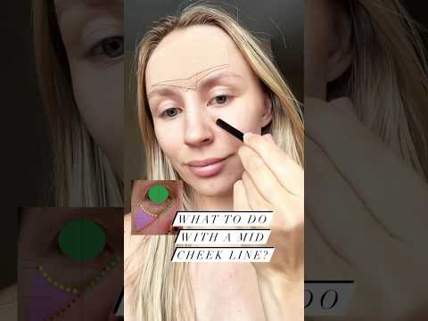What To Do With A Mid Cheek Line?