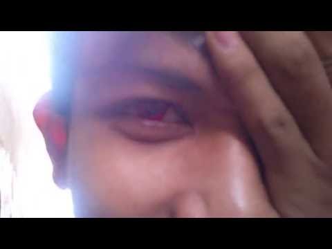 Biokinesis Sharingan